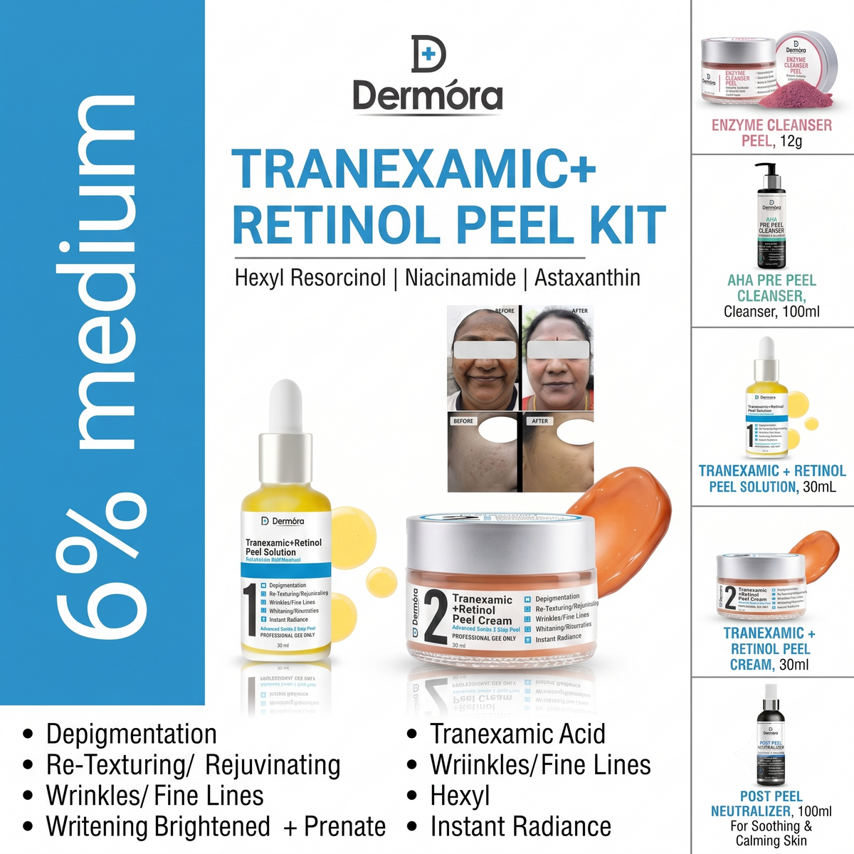 The Dynamic Duo: Why Tranexamic Acid + Retinol is Your Ultimate Skin Transformation Secret