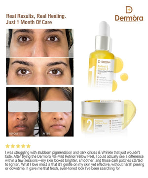 Dermora Professional 4% Mild Advanced 2-Step Retinol Yellow Peel Kit With 5-Steps | Enzyme Cleanser Peel (12g) | Pre Peel Cleanser (100ml) | Retinol & Vitamin-C Yellow Peel Solution (30ml) | Retinol Yellow Peel Cream (30ml) | Post Peel Neutralizer (100ml)