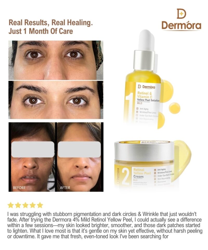 Dermora Professional 4% Mild Advanced 2-Step Retinol Yellow Peel Kit With 5-Steps | Enzyme Cleanser Peel (12g) | Pre Peel Cleanser (100ml) | Retinol & Vitamin-C Yellow Peel Solution (30ml) | Retinol Yellow Peel Cream (30ml) | Post Peel Neutralizer (100ml)